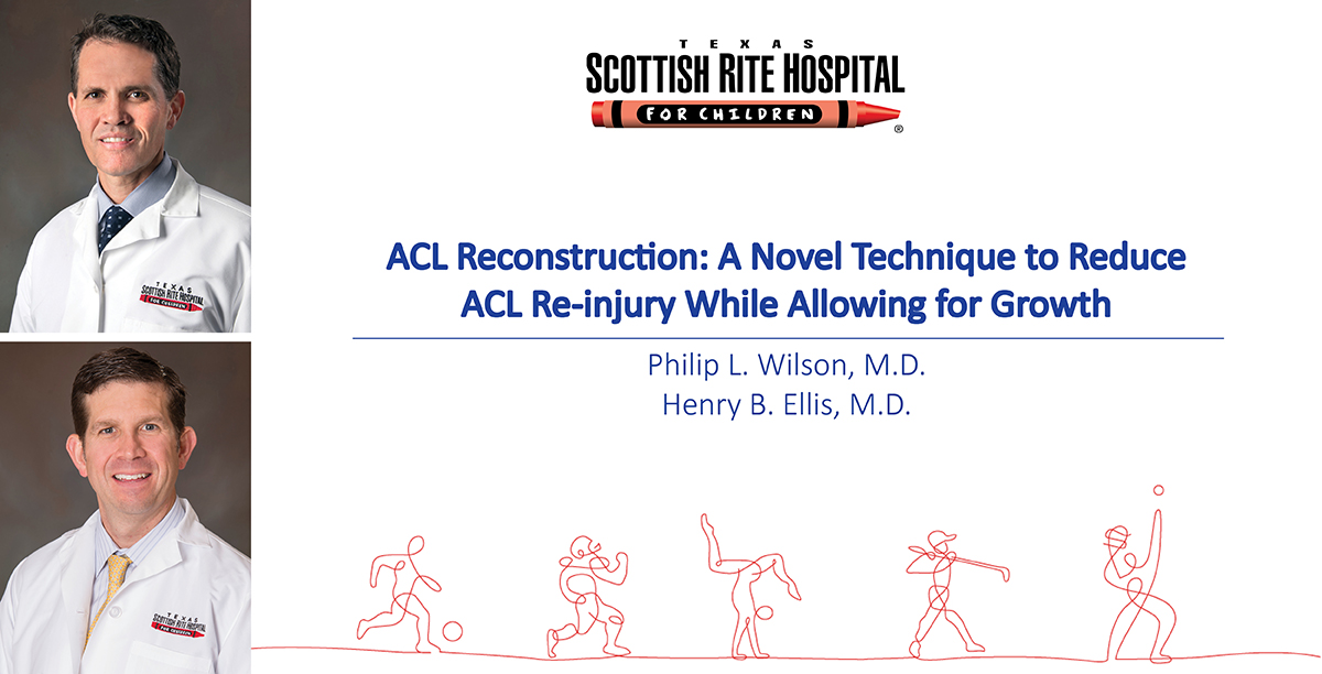 A New Approach in ACL Reconstruction Helps to Reduce Re-injury in High Risk Population