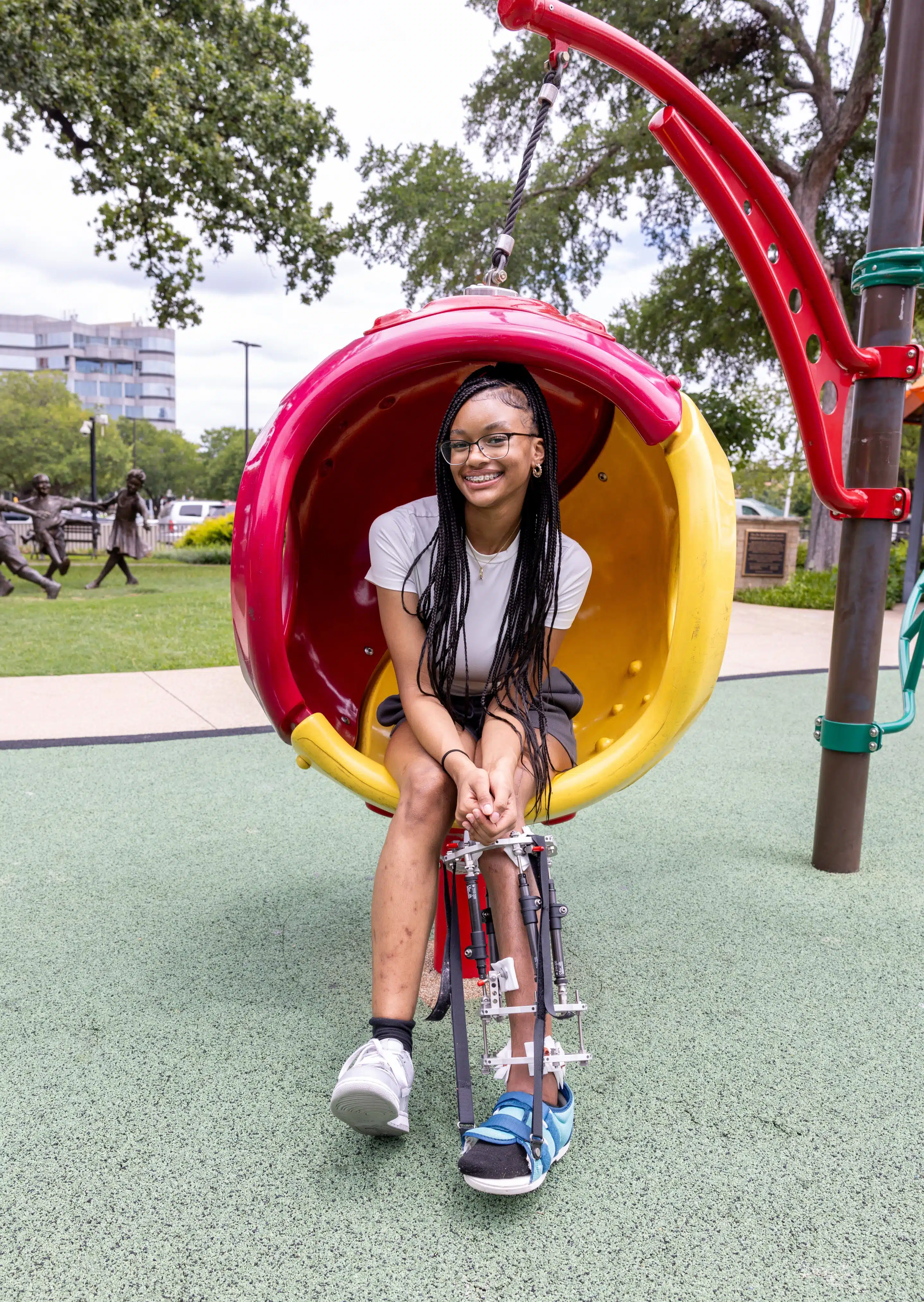 Young girl in external fixator or frame.