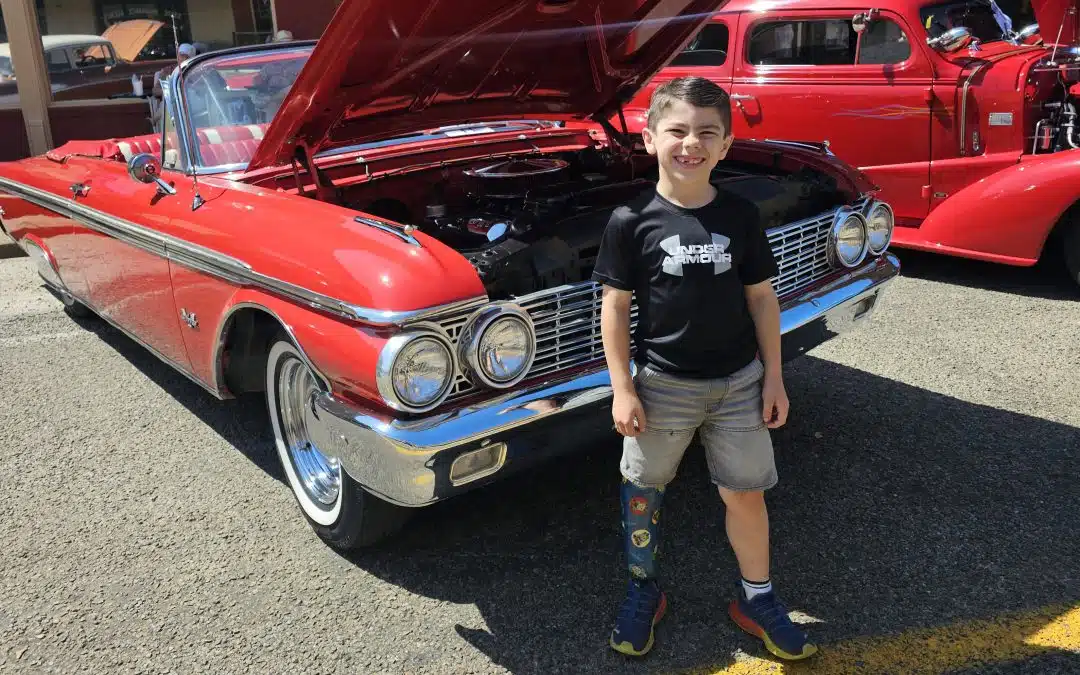 How Ryan Lives Life to the Fullest With A Limb Difference
